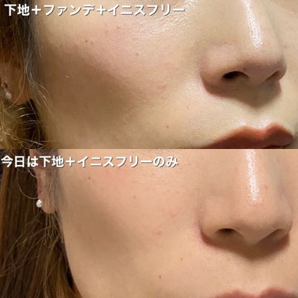 薬用 しみ 集中対策 美容液/メラノCC/美容液を使ったクチコミ(5枚目)