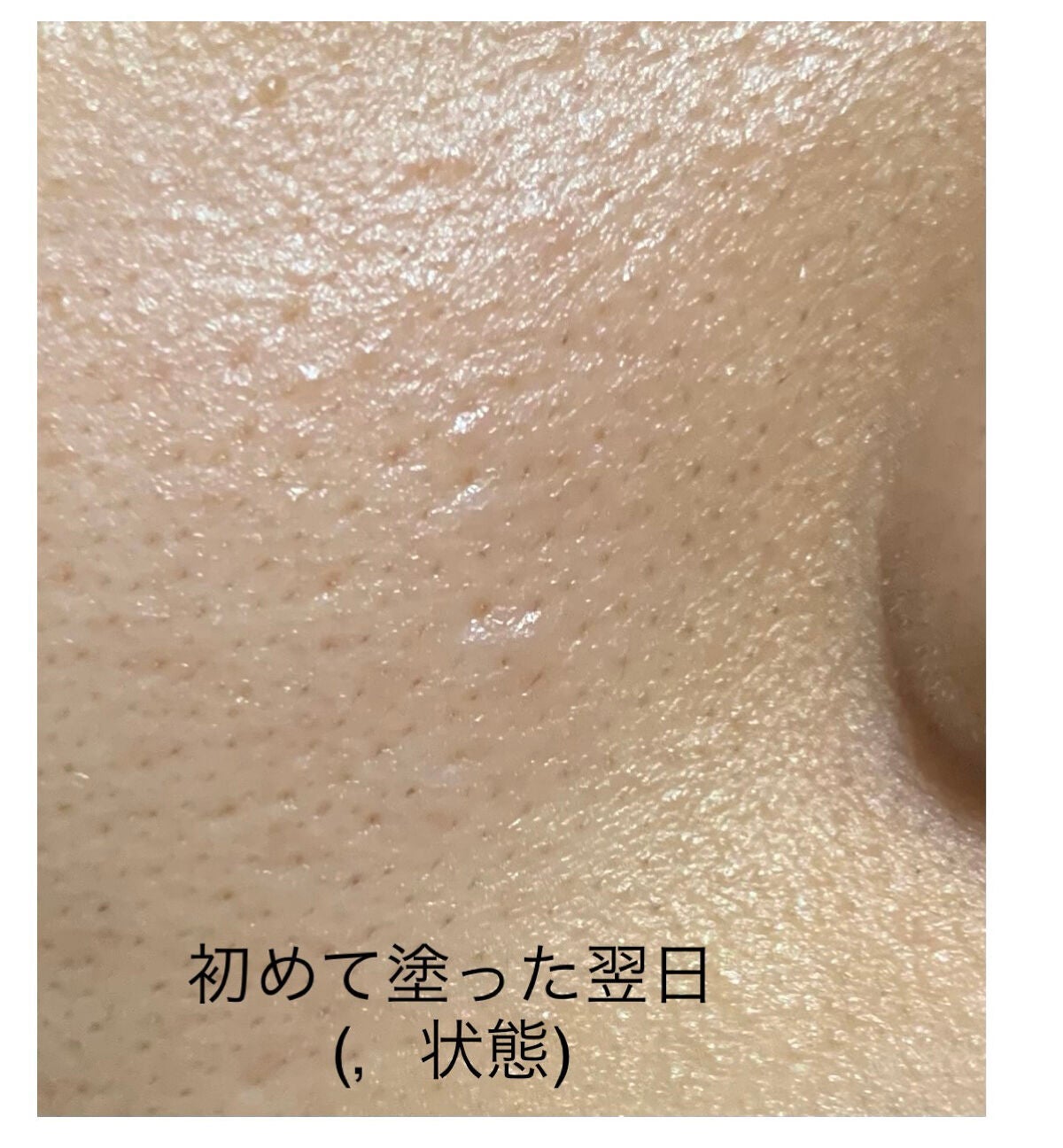 RXザ・ビタミンC23セラム/COSRX/美容液を使ったクチコミ(4枚目)