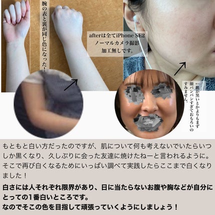 DHC ビタミンCハードカプセル/DHC/美容サプリメントを使ったクチコミ(2枚目)