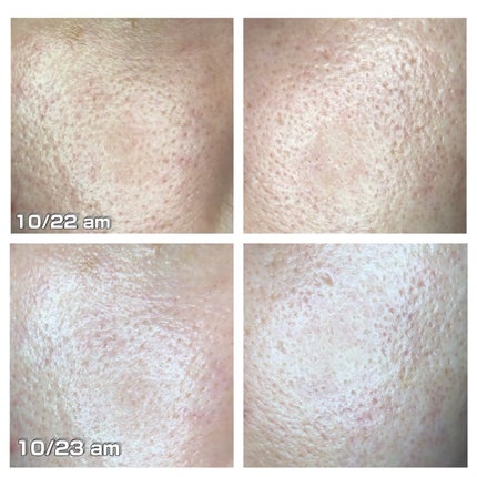 イドラビオ エイチツーオー/ビオデルマ/クレンジングウォーターを使ったクチコミ(2枚目)