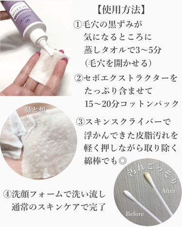 ANACIS アクレオンセボエクストラクターのクチコミ「9/15日〆🉐50%ポイントバック‼️📣美人小鼻👃✨ 毛穴の黒ずみ・皮脂が気になる方に激推し‼.....」（3枚目）