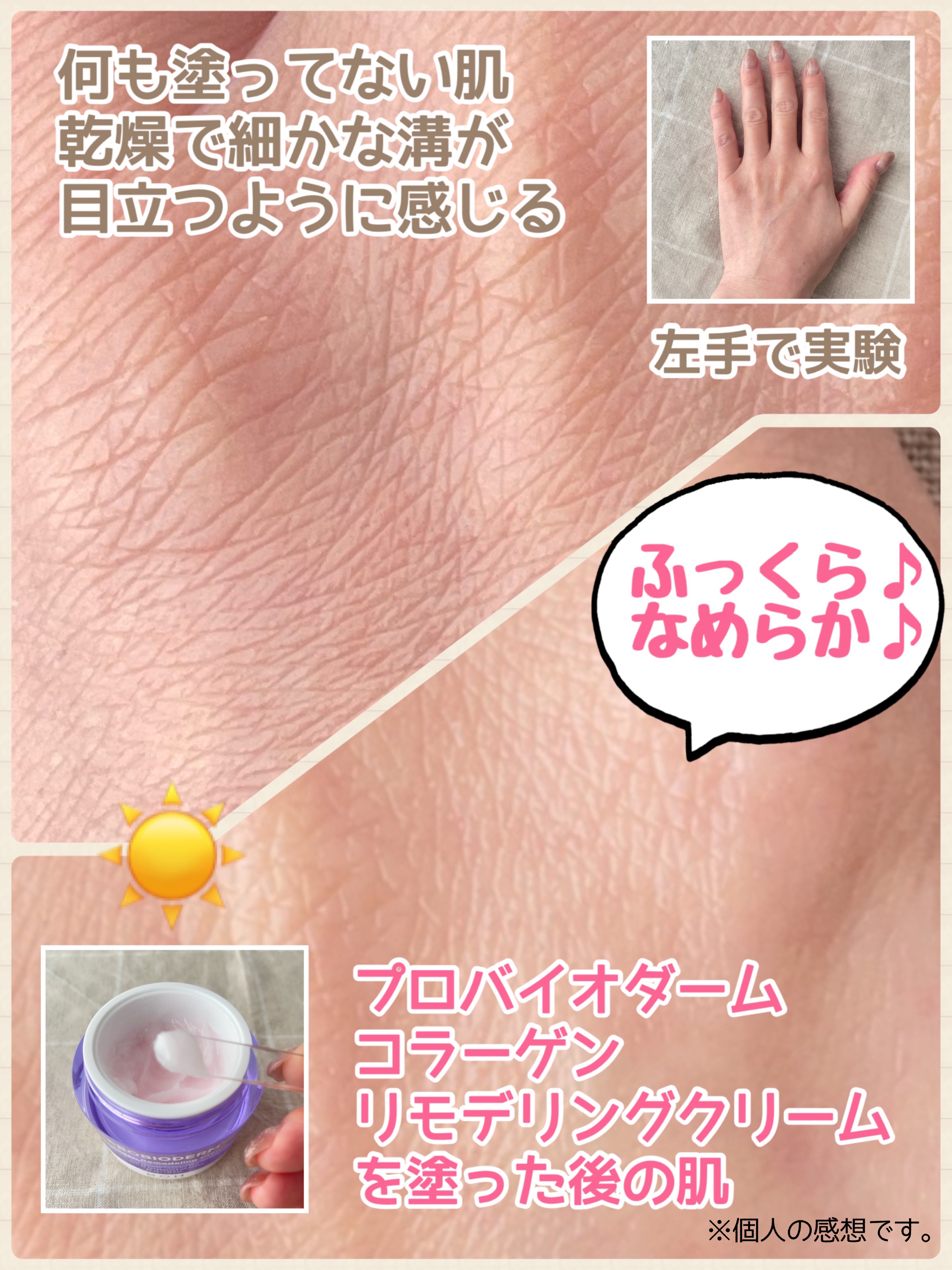 バイオヒールボ プロバイオダーム 3Dリフティングクリーム/BIOHEAL BOH/フェイスクリームを使ったクチコミ（3枚目）