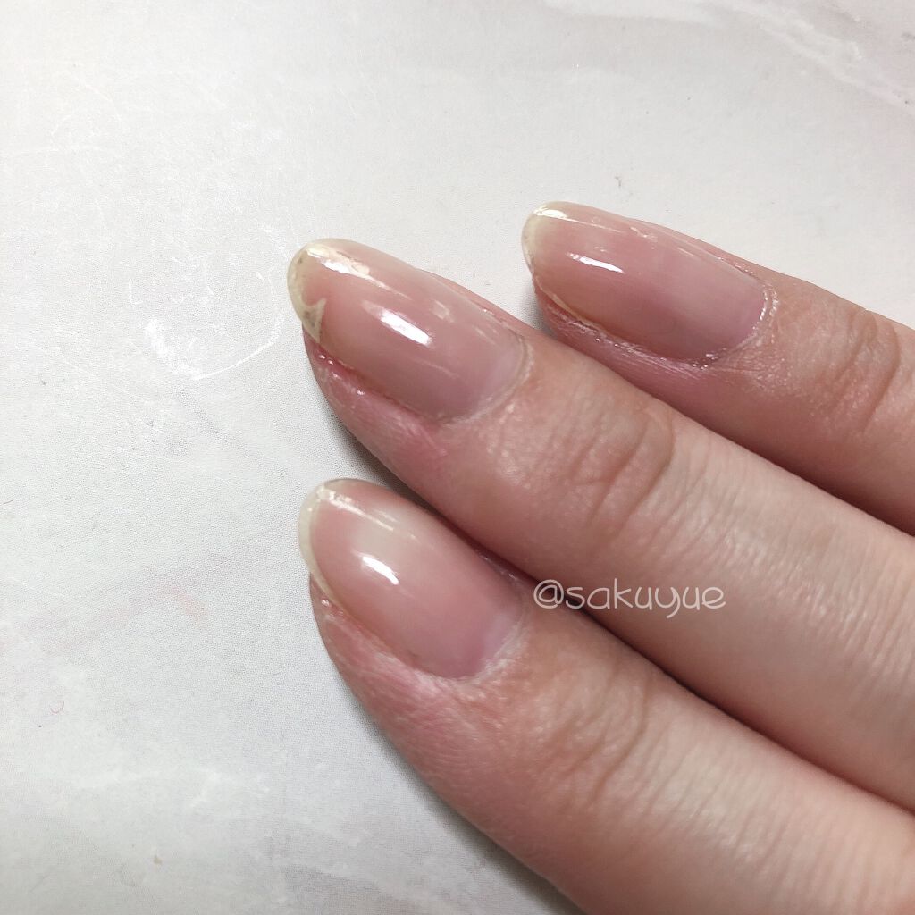 自爪補強コート/デュカート/ネイルベースコートを使ったクチコミ（2枚目）