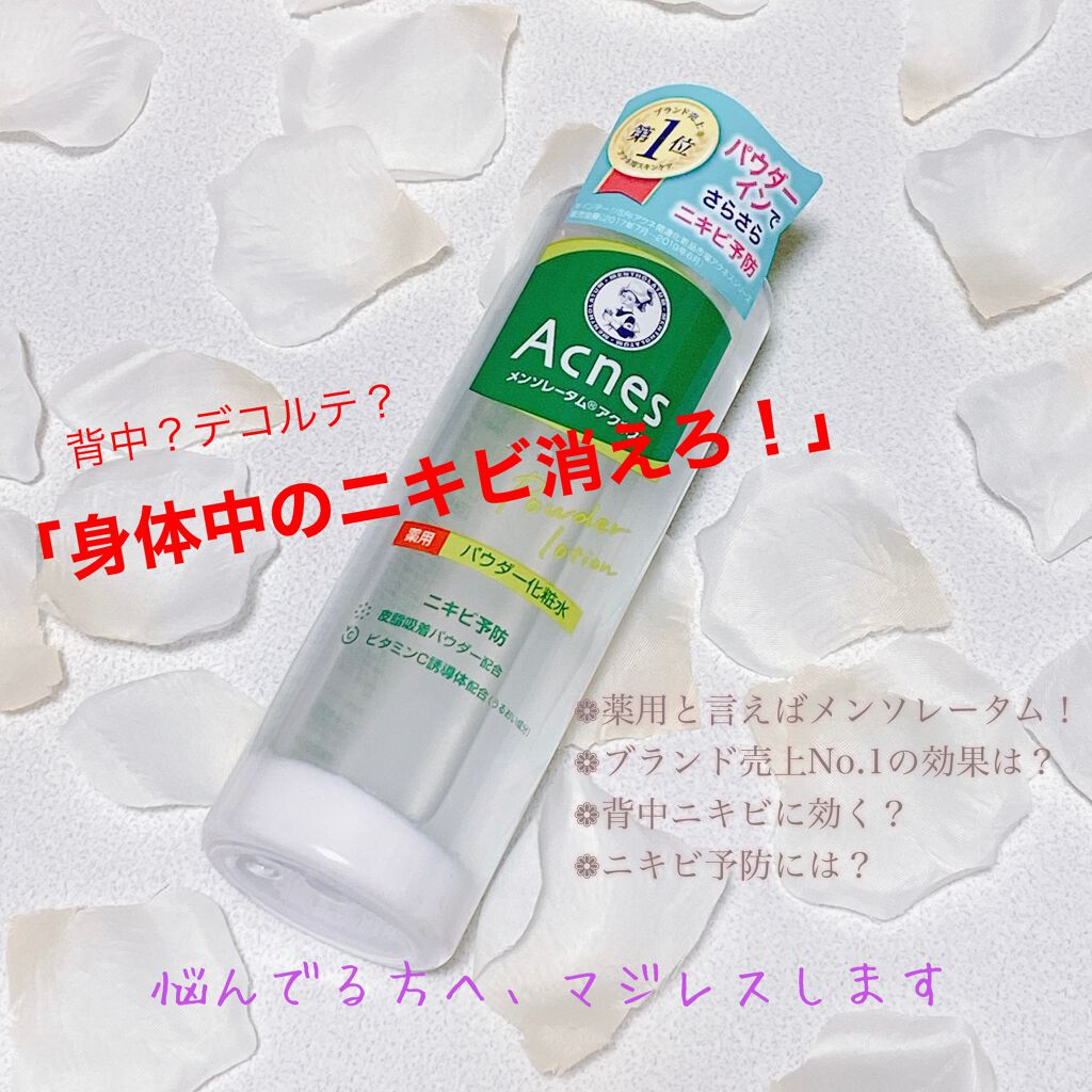 薬用パウダー化粧水/メンソレータム アクネス/化粧水を使ったクチコミ(1枚目)