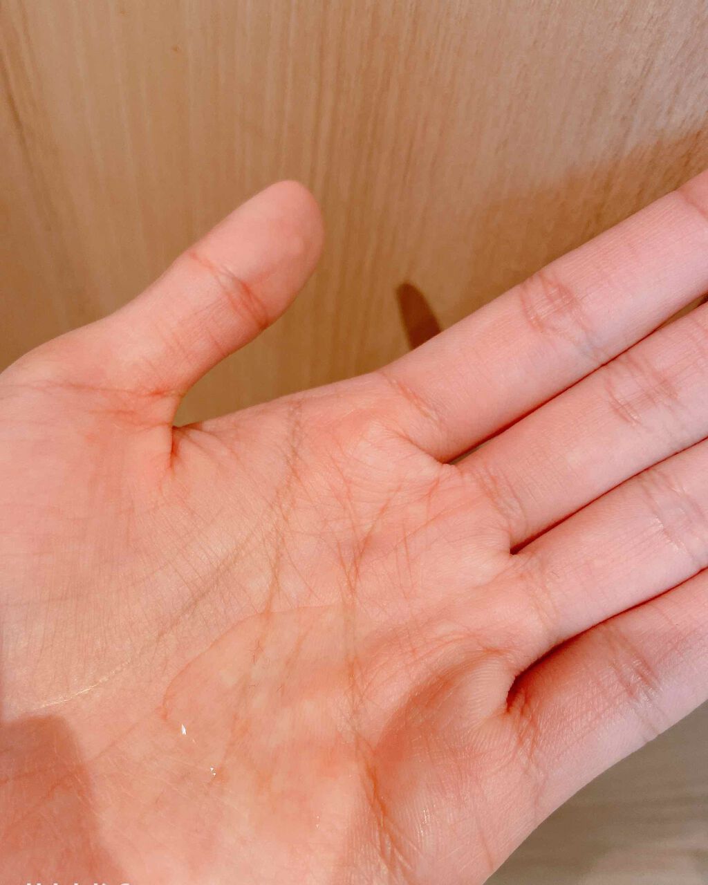薬用モイスチャー化粧水/メンソレータム アクネス/化粧水を使ったクチコミ(2枚目)