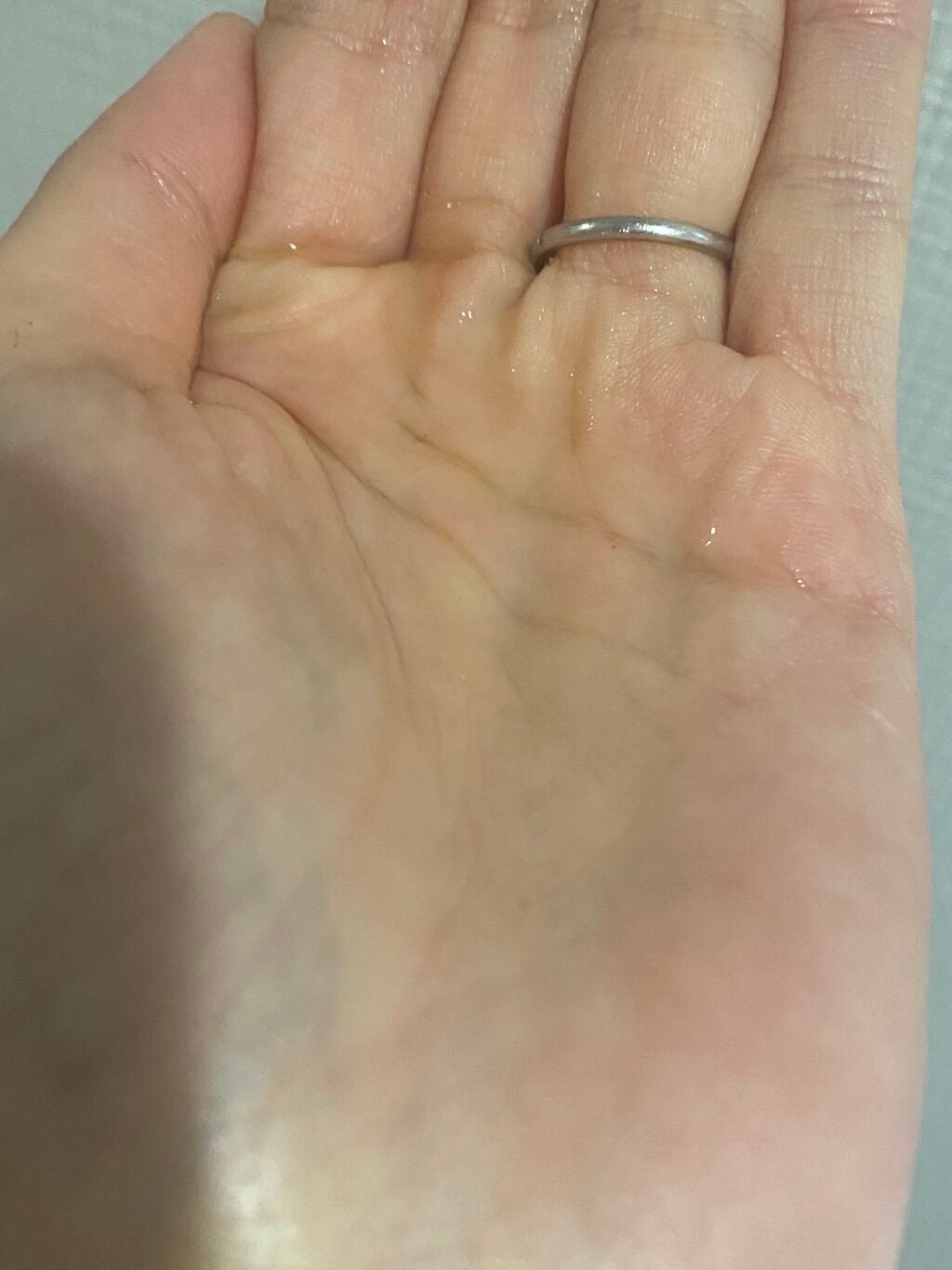 トレリアン 薬用モイスチャーローション/ラ ロッシュ ポゼ/化粧水を使ったクチコミ(3枚目)