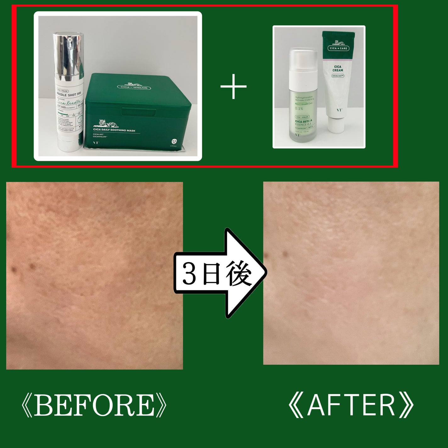 リードルショット300/VT/美容液を使ったクチコミ(7枚目)