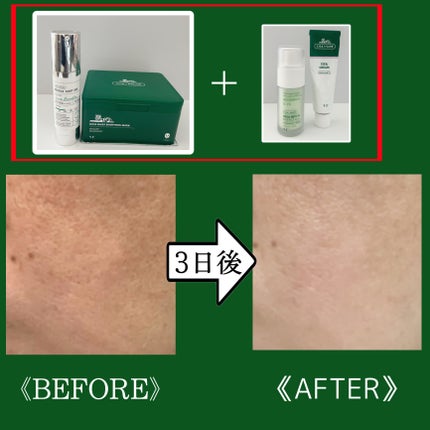 リードルショット300/VT/美容液を使ったクチコミ(7枚目)