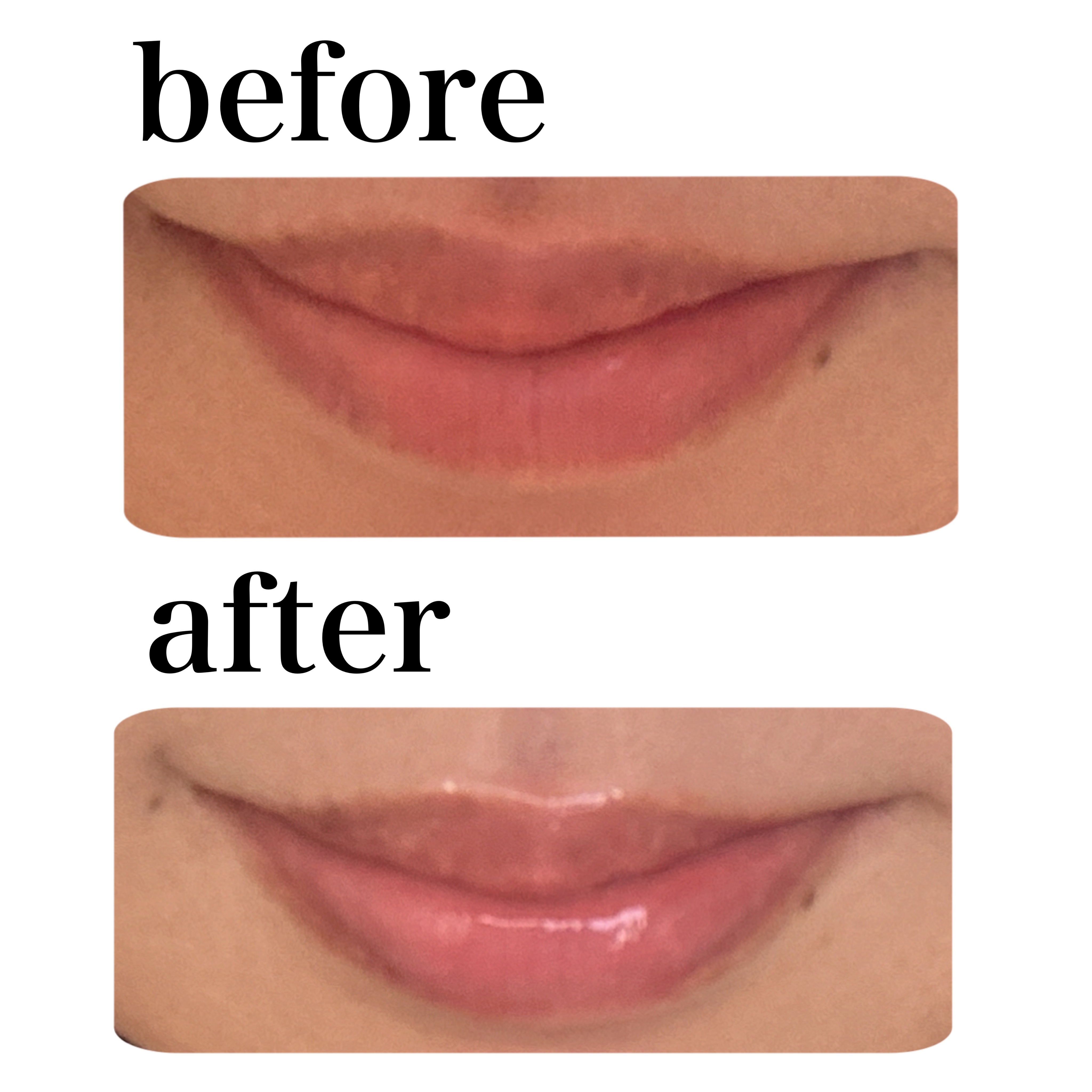 キューミ―ボムショットリッププランパー/AGARISM/リッププランパーを使ったクチコミ（2枚目）