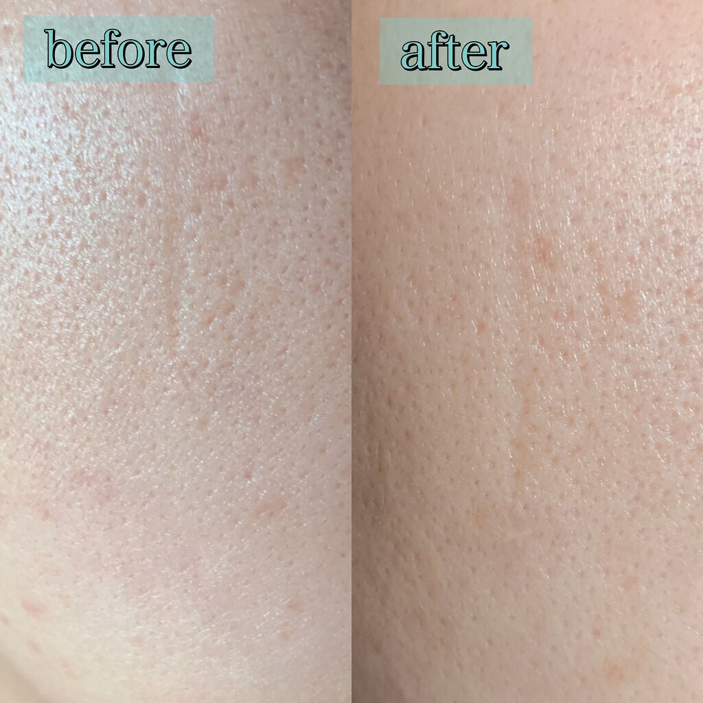 おうちdeエステ 肌をなめらかにする マッサージ洗顔ジェル/ビオレ/その他洗顔料を使ったクチコミ(6枚目)