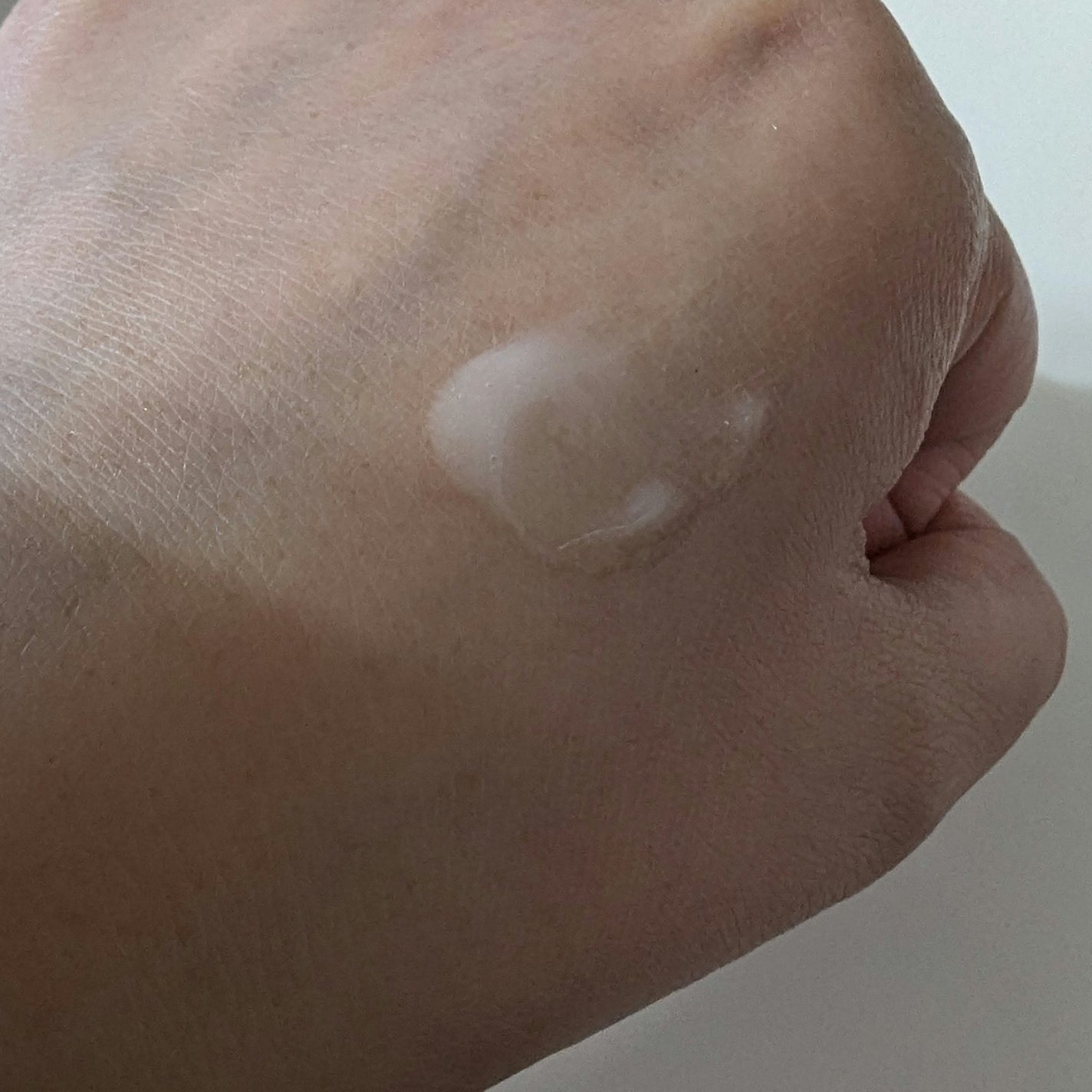 LUNA on LIPS 「CICA×HYALON 保湿レチAリードルS100VTのCIC..」(6枚目)