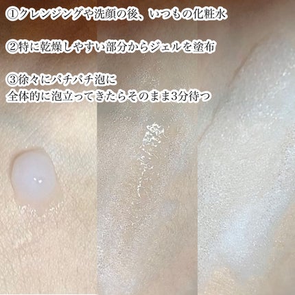 マジックバブルエッセンスパックMINI/BAKER7/シートマスク・パックを使ったクチコミ(5枚目)