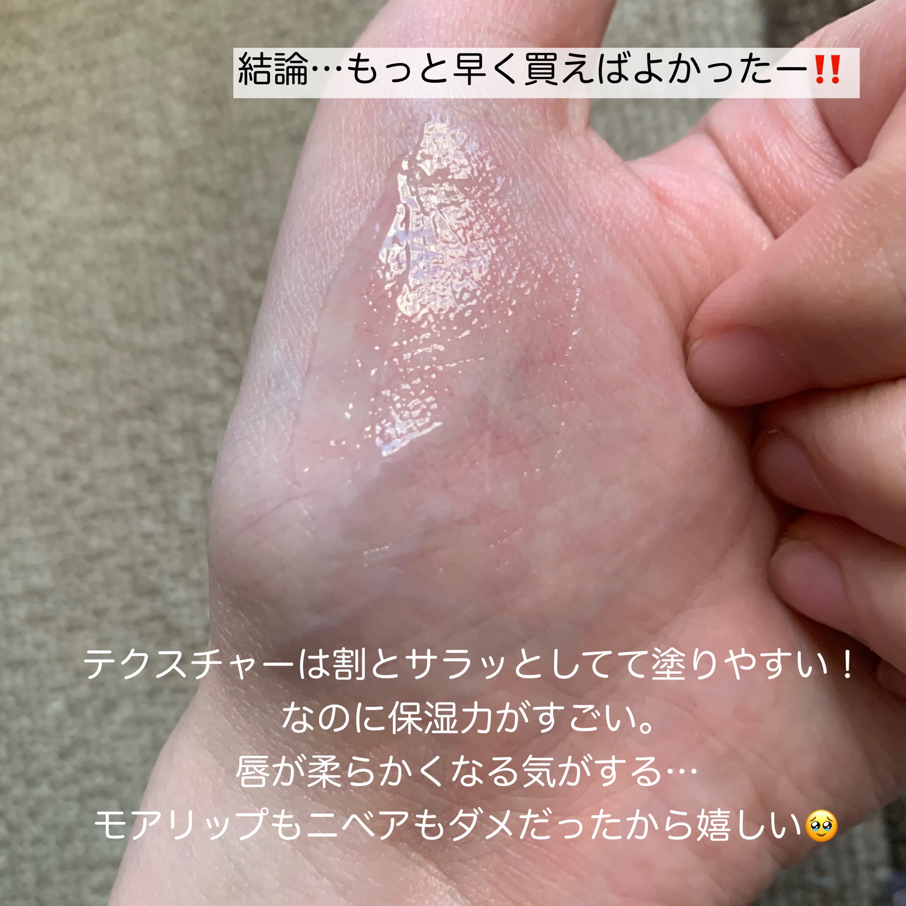 ダーマパワーX リップエッセンス/オバジ/リップ美容液を使ったクチコミ（3枚目）