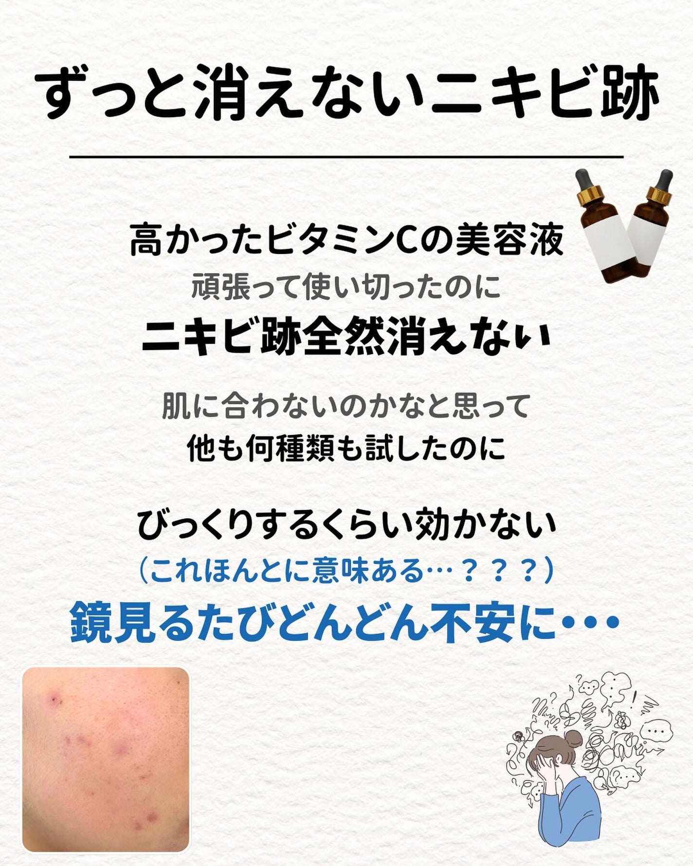 ニキビを諦めかけた人の味方|エマ🫧 on LIPS 「【始めましてのあなたへ✨】「私は一緒肌治らないのかな…」と過去..」(2枚目)