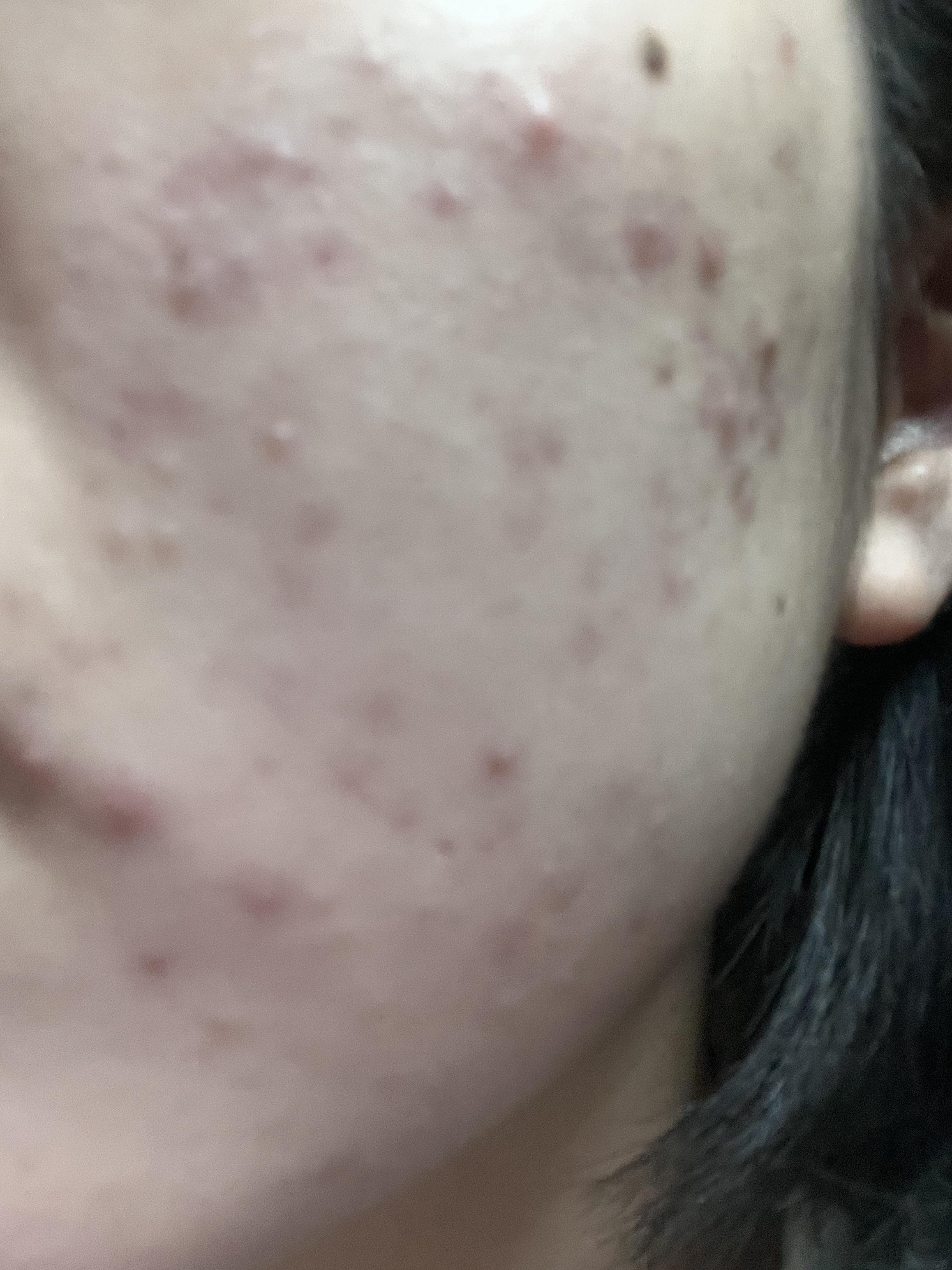 潤浸保湿 乳液/キュレル/乳液を使ったクチコミ（3枚目）