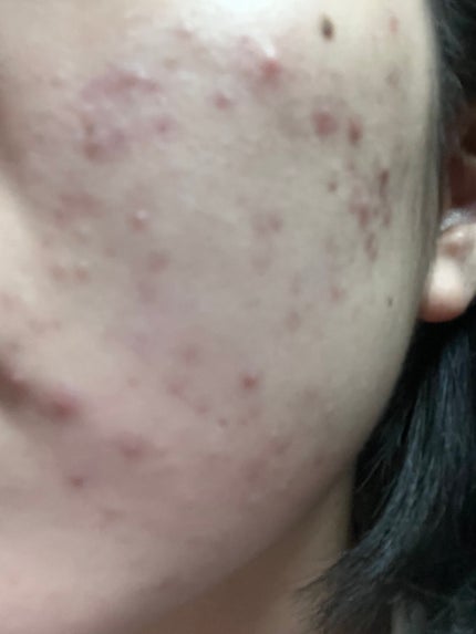 潤浸保湿 乳液/キュレル/乳液を使ったクチコミ(3枚目)