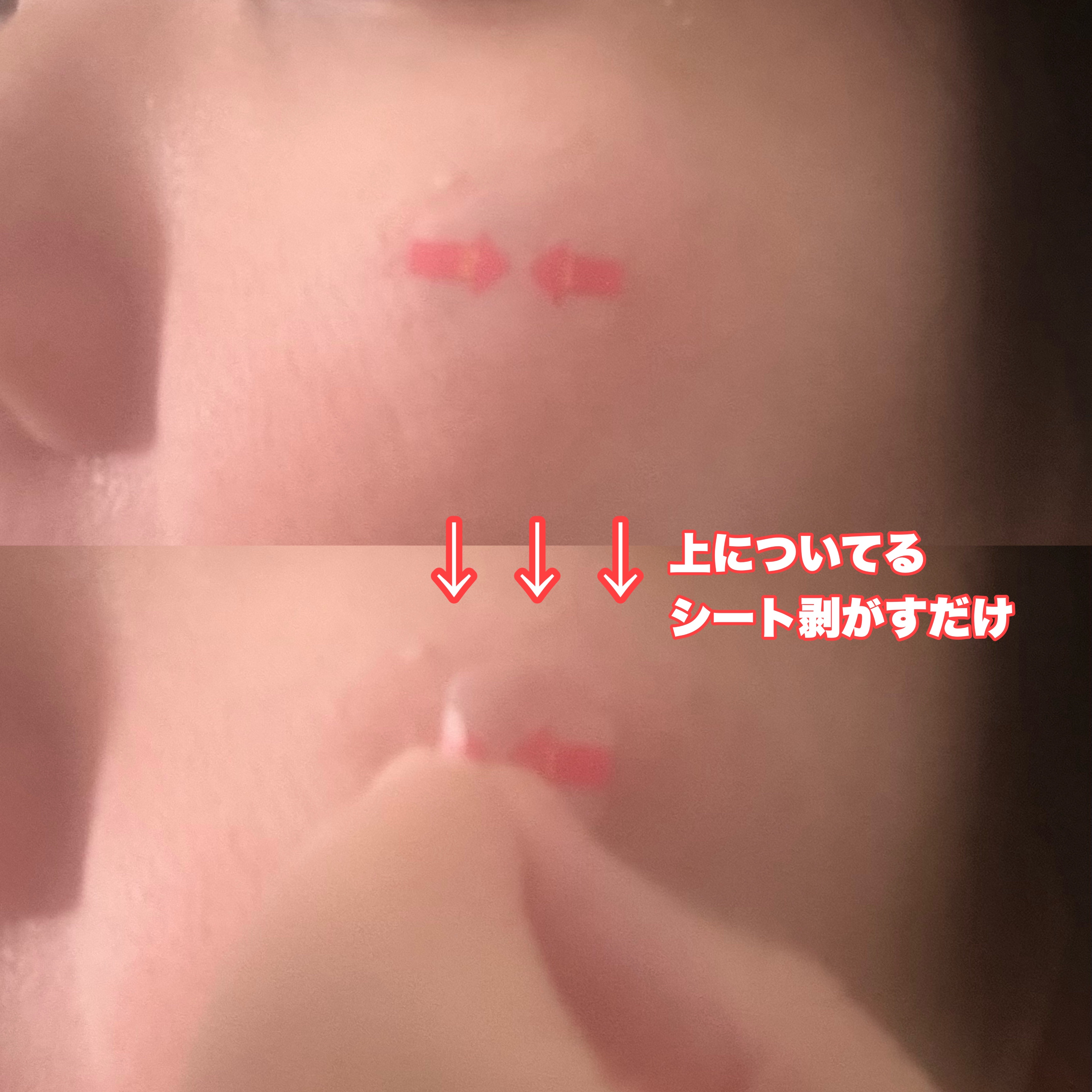 キャッチミーパッチ/CATCH ME PATCH/にきびパッチを使ったクチコミ（3枚目）