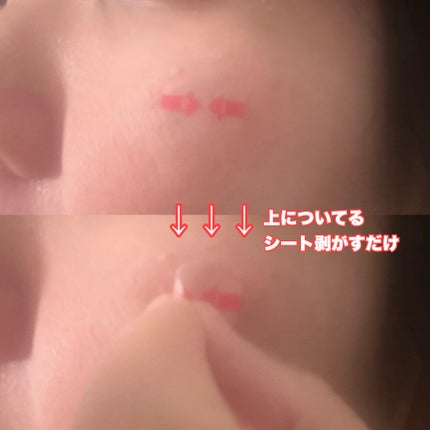 キャッチミーパッチ/CATCH ME PATCH/にきびパッチを使ったクチコミ(3枚目)