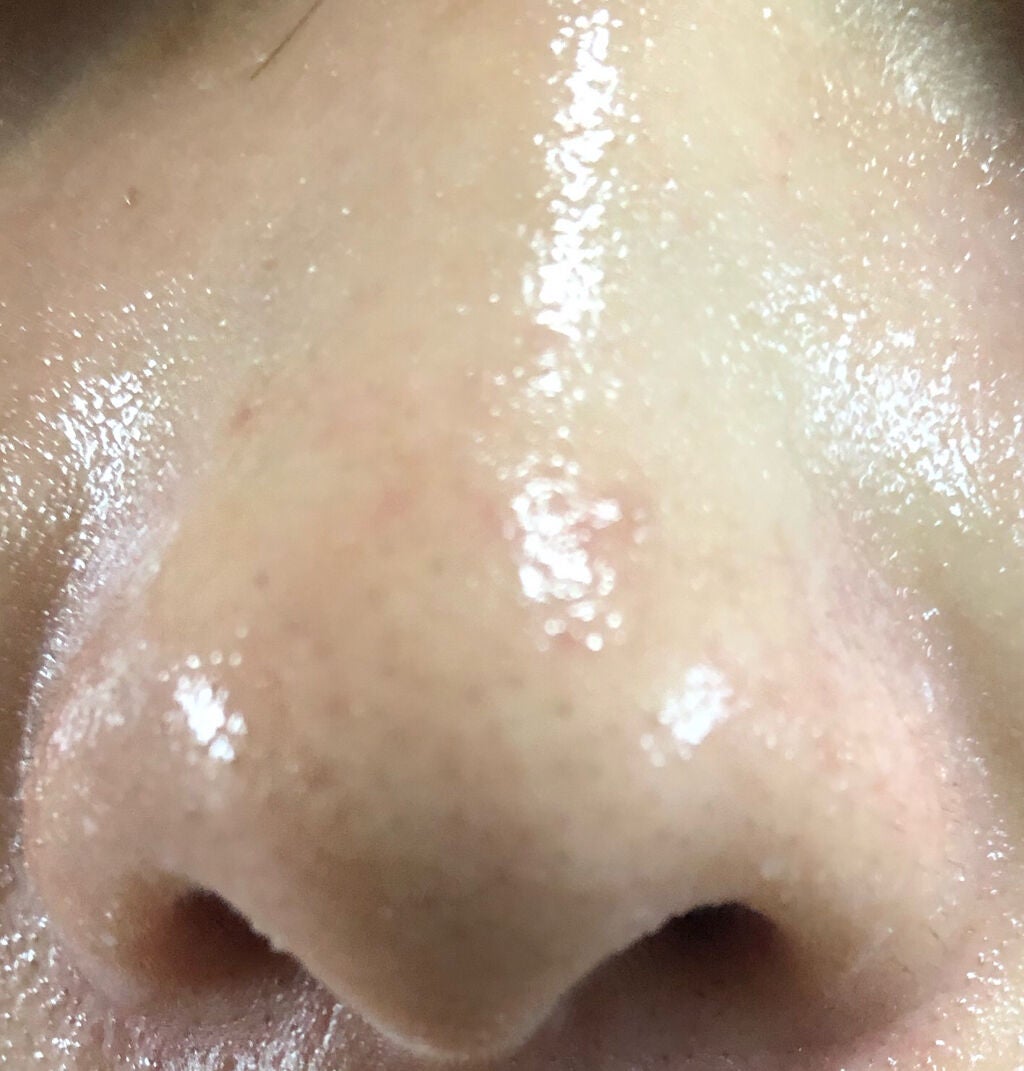 ノーモアブラックヘッド(ノーズピーリング)/One-day's you/スクラブ・ゴマージュを使ったクチコミ(3枚目)