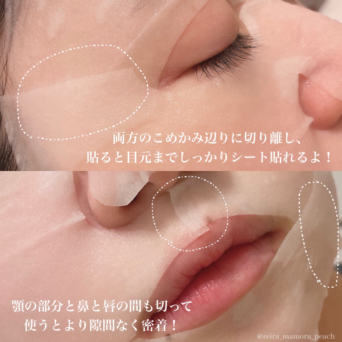 弱酸性pHシートマスク ドクダミフィット/Abib /シートマスク・パックを使ったクチコミ(3枚目)