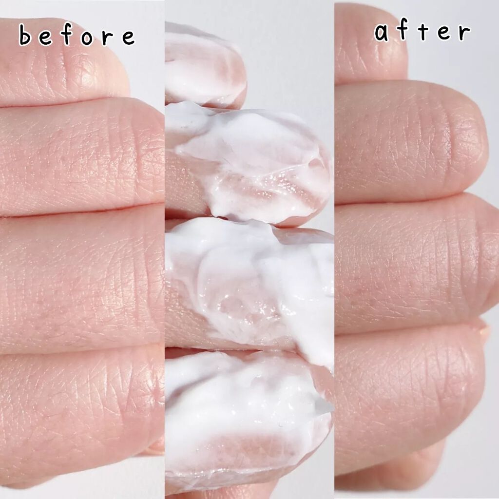 エピリムーバー/TBC/除毛クリームを使ったクチコミ(5枚目)