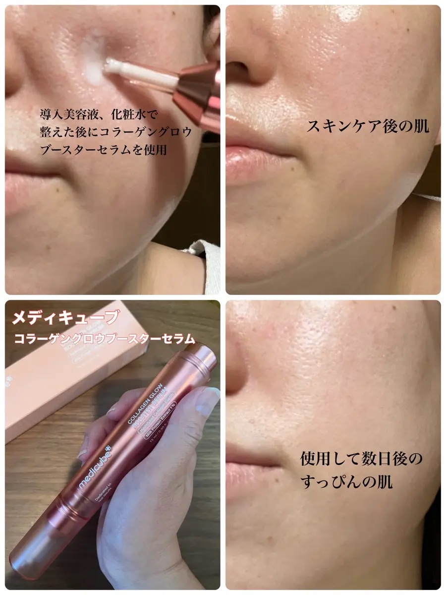 コラーゲングローブースターセラム/MEDICUBE/美容液を使ったクチコミ（2枚目）