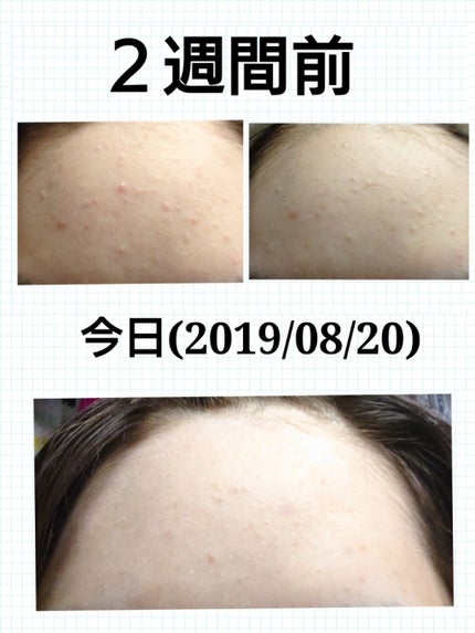 ロゼット洗顔パスタ アクネクリア/ロゼット/洗顔フォームを使ったクチコミ(2枚目)