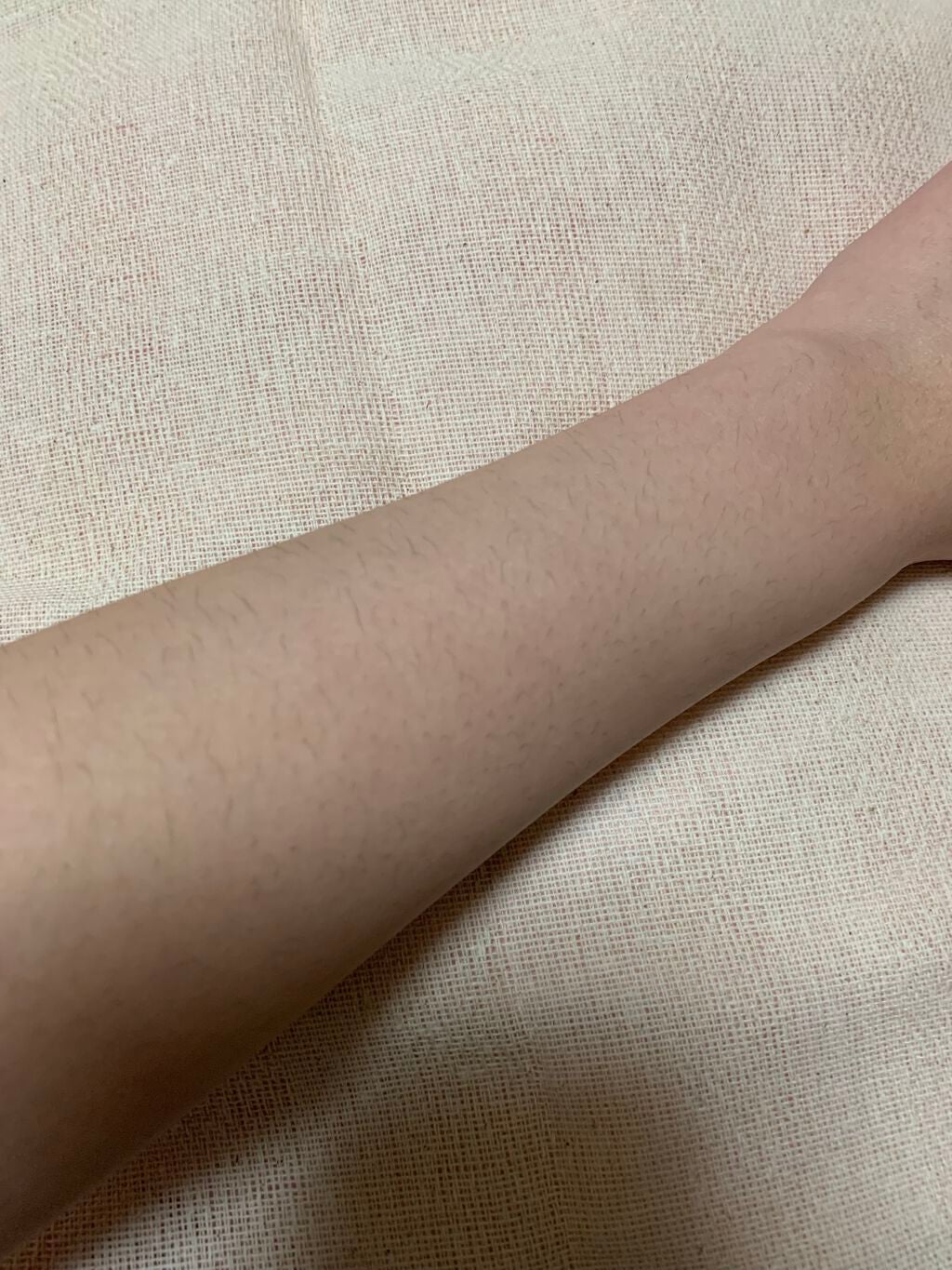 無名のひよこ on LIPS 「こんにちは、無名のひよこです(•ө•)皆さん、毛の処理どうして..」(3枚目)