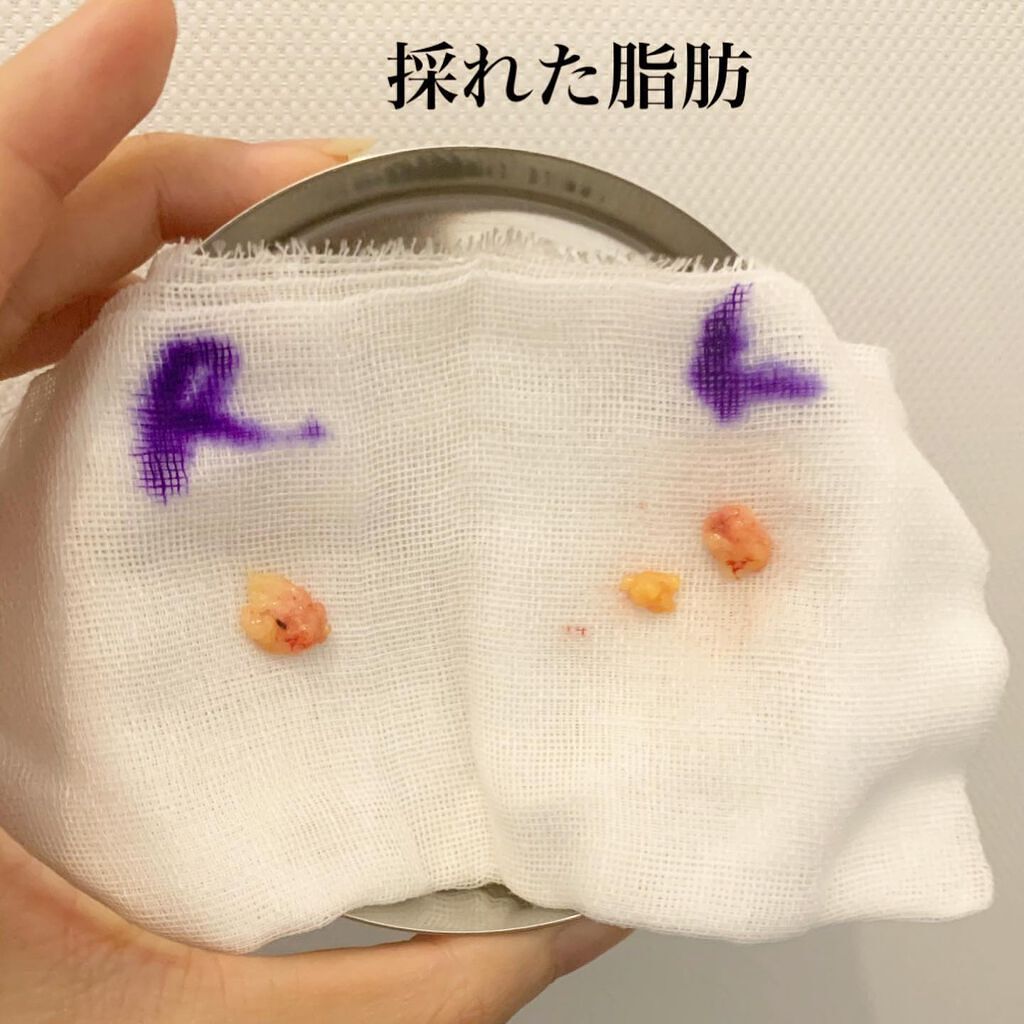 mipo1212ð€ on LIPS ãâšâšç®ã®äžã®ã¯ãåãïŒè±èïŒèèªæ³šå
¥ã¬ãâšï¿œï¿œãåŸ
ããããŸãã..ãïŒ5æç®ïŒ