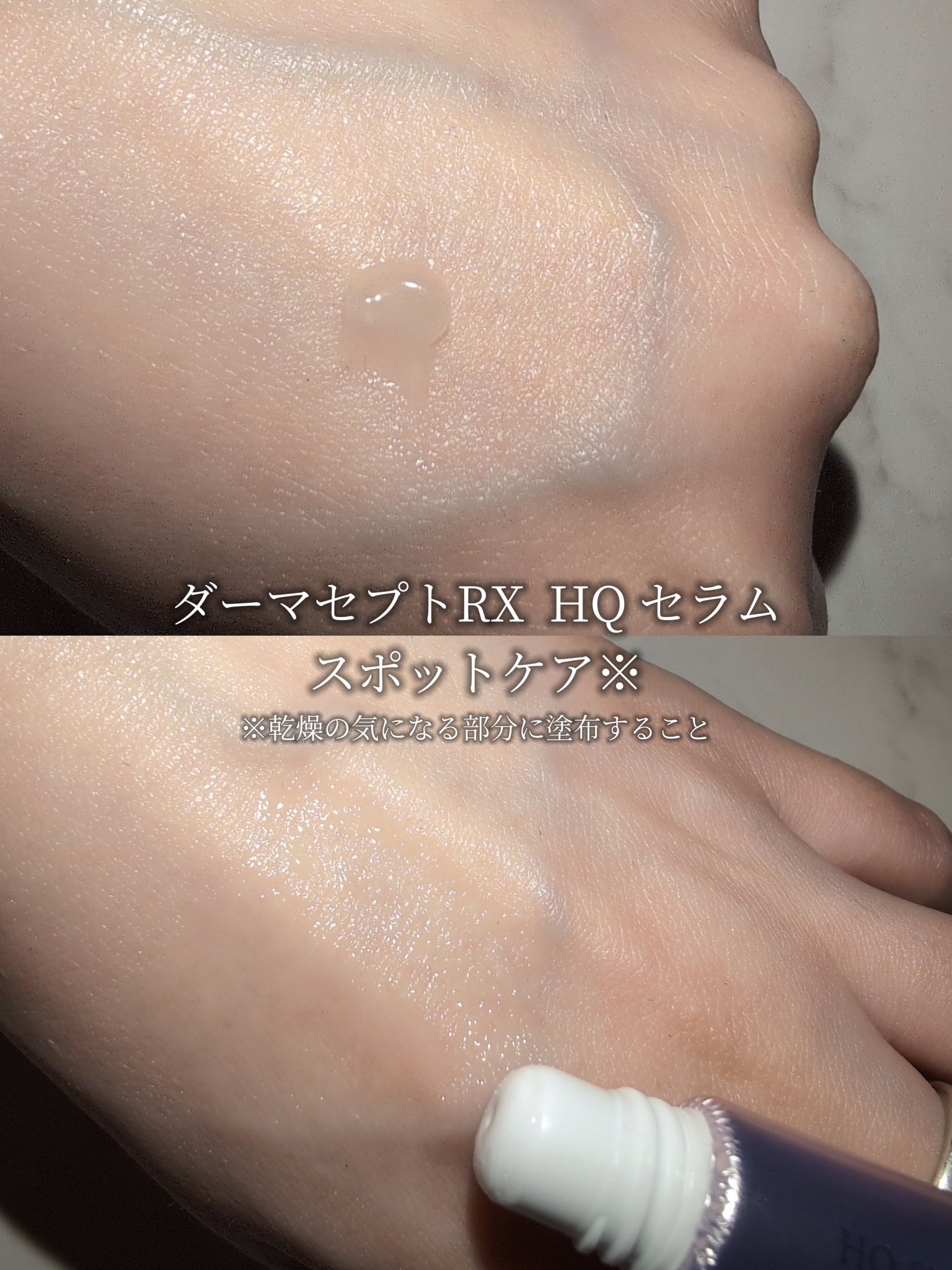 HQ セラム/ダーマセプトRX/美容液を使ったクチコミ（3枚目）
