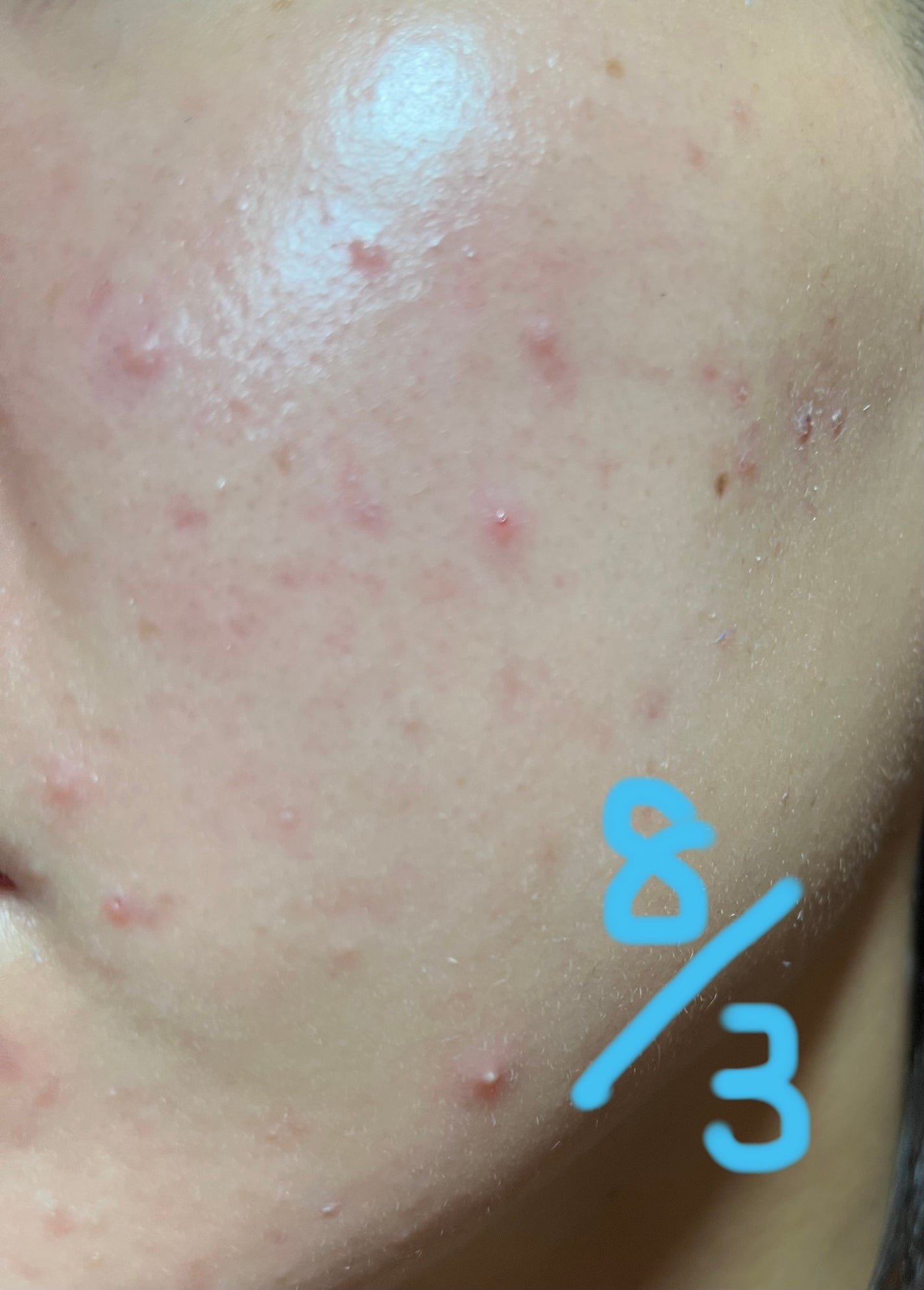 パケ買いはしないよ on LIPS 「【使った商品】セレクトオーガニックスパ 化粧水✼••┈┈••✼..」(2枚目)