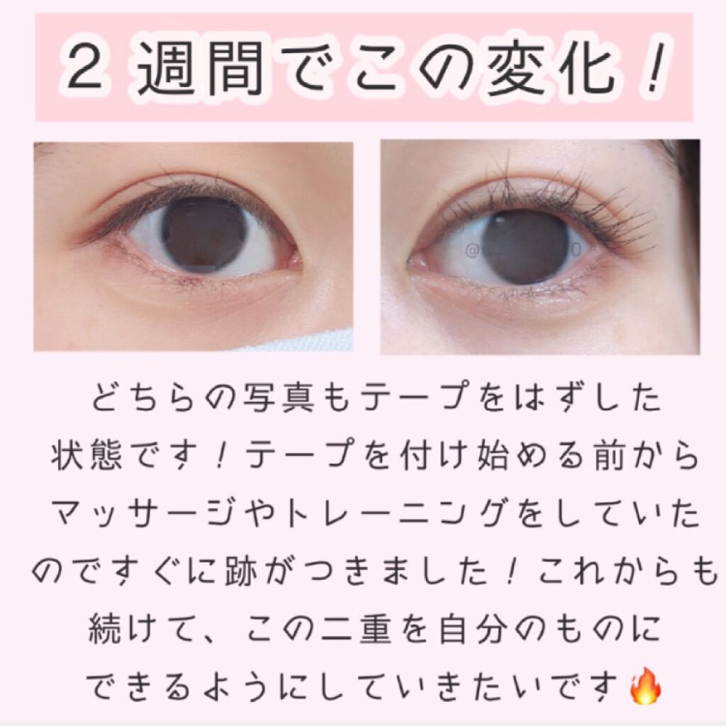 ワンダーアイリッドテープ Extra/D-UP/二重まぶた用アイテムを使ったクチコミ（2枚目）