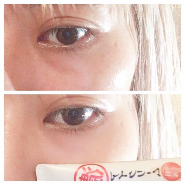 目元ふっくらクリーム なめらか本舗の効果に関する口コミ アイクリームの大事さに気づいた 大きなクマ By ようだぴんこ 混合肌 30代後半 Lips