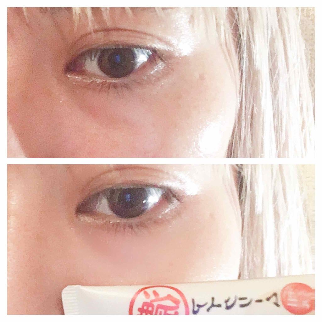 目元ふっくらクリーム NC/なめらか本舗/アイケア・アイクリームを使ったクチコミ(2枚目)