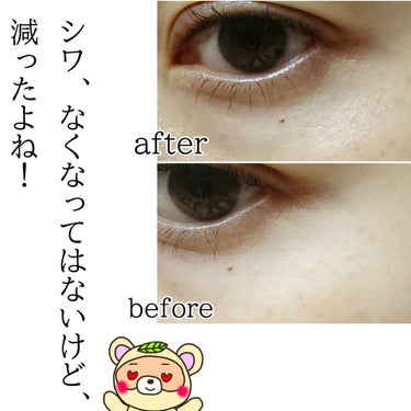 LOWAN STEM EYECREAM/LOWAN/アイケア・アイクリームを使ったクチコミ（3枚目）