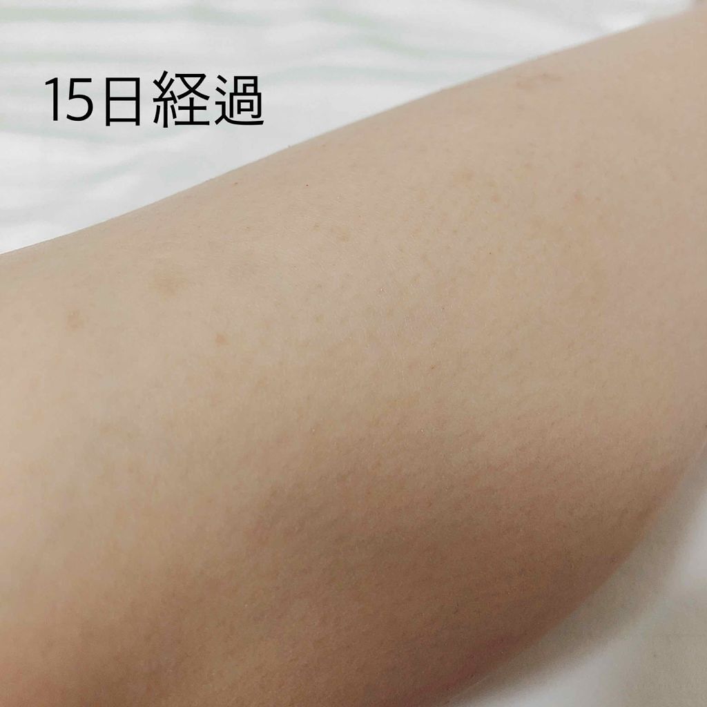 ケアノキュア（医薬品）/小林製薬/その他を使ったクチコミ（3枚目）