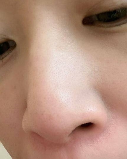 ゼロ毛穴クレイパック/MEDICUBE/洗い流すパック・マスクを使ったクチコミ(10枚目)