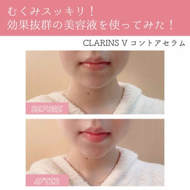 Vコントアセラム/CLARINS/美容液を使ったクチコミ（1枚目）