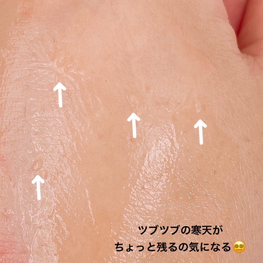 アスタリライズV3エッセンス/アトレージュ AD＋/美容液を使ったクチコミ（3枚目）