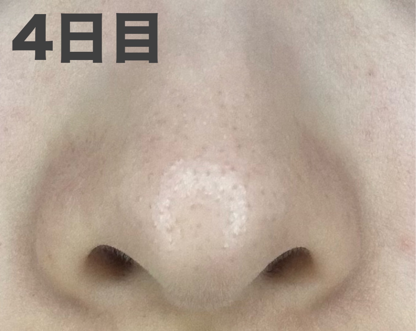 デュオ ザ ウォッシュ ブラックリペア/DUO/洗顔パウダーを使ったクチコミ（2枚目）