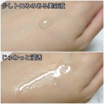 バイタルドロップ/EVERYSKIN/美容液を使ったクチコミ(3枚目)