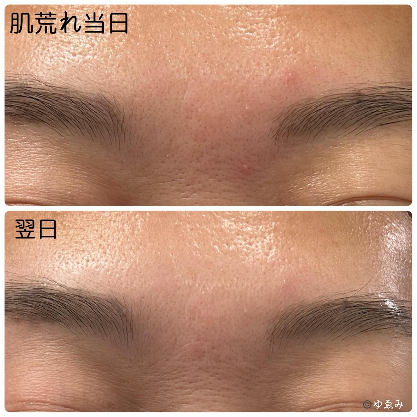 エクソソームシカセラム/MEDICUBE/美容液を使ったクチコミ（3枚目）