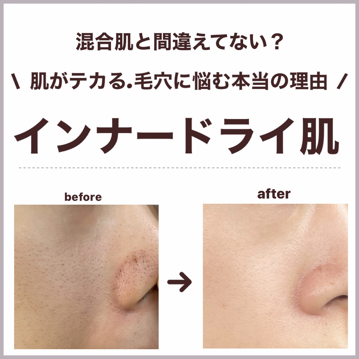 潤浸保湿 化粧水 III とてもしっとり/キュレル/化粧水を使ったクチコミ（1枚目）