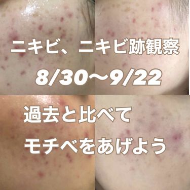 アドバンスドリペア ボディローション ヴァセリンを使った口コミ こんにちは 見てくださってありがとうござい By ののの 代前半 Lips