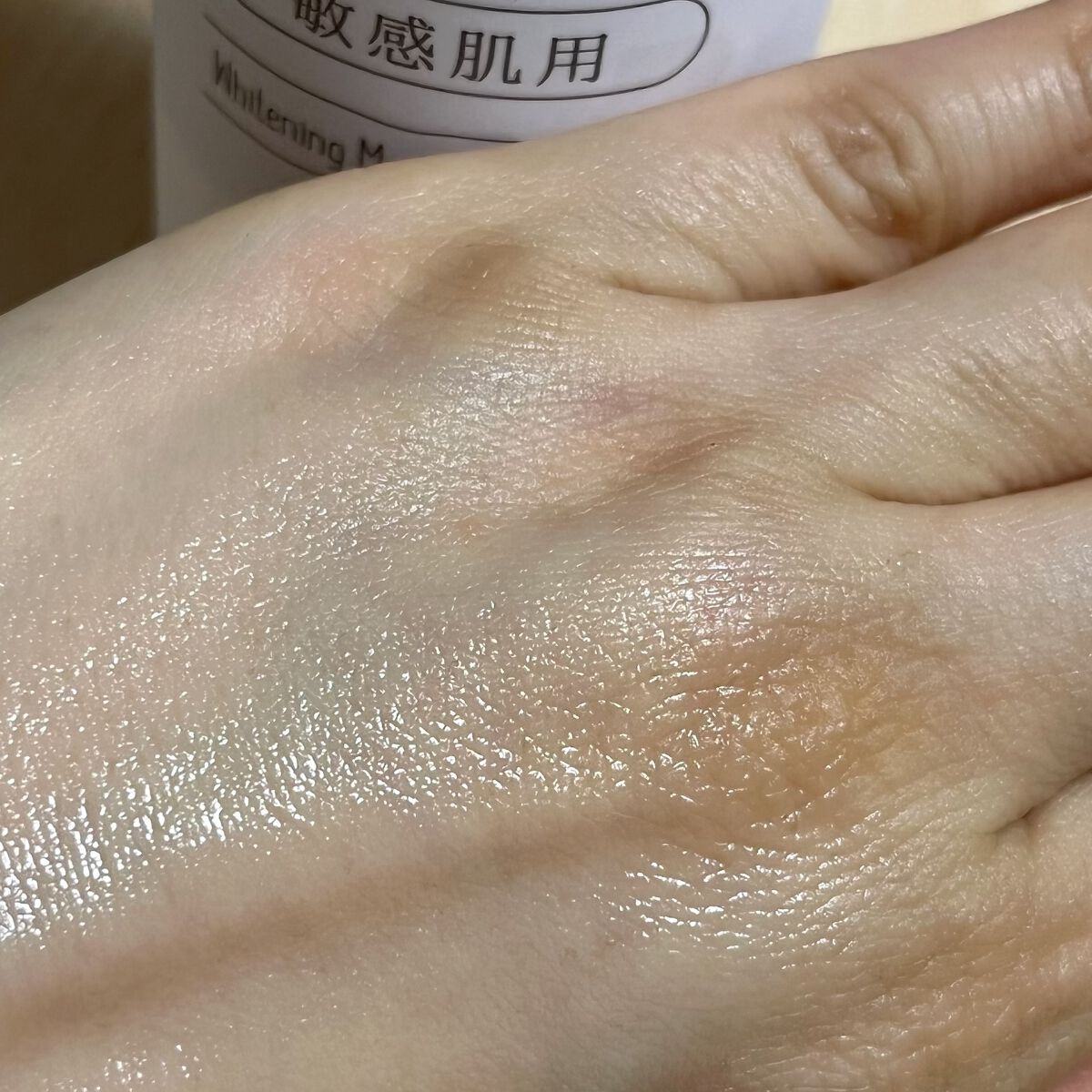 美白とニキビケア ボタニカル高保湿化粧水（薬用）/NICE ＆ QUICK/化粧水を使ったクチコミ（3枚目）