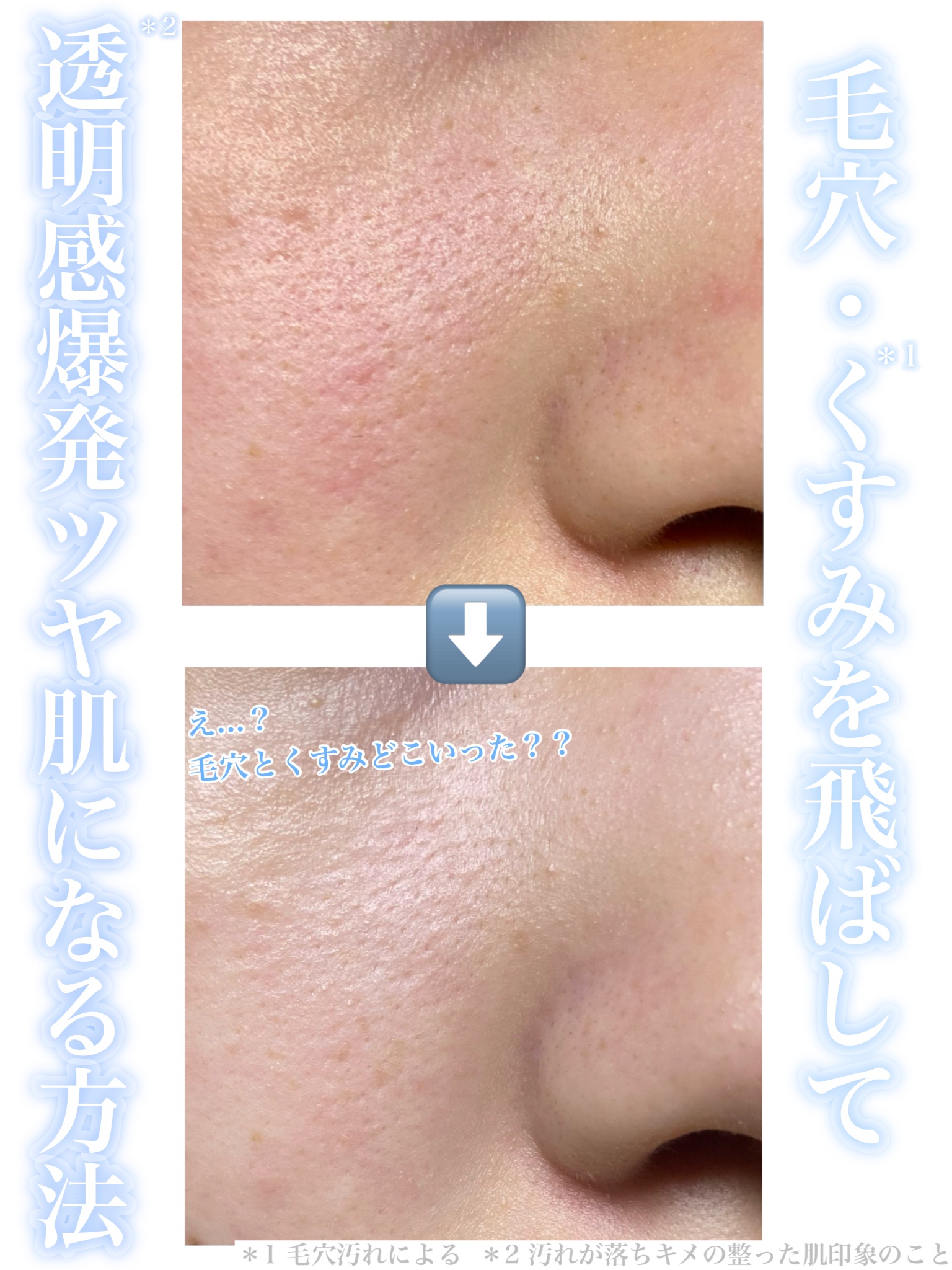 トーンアップホワイト マッドマスク/by : OUR/シートマスク・パックを使ったクチコミ（1枚目）