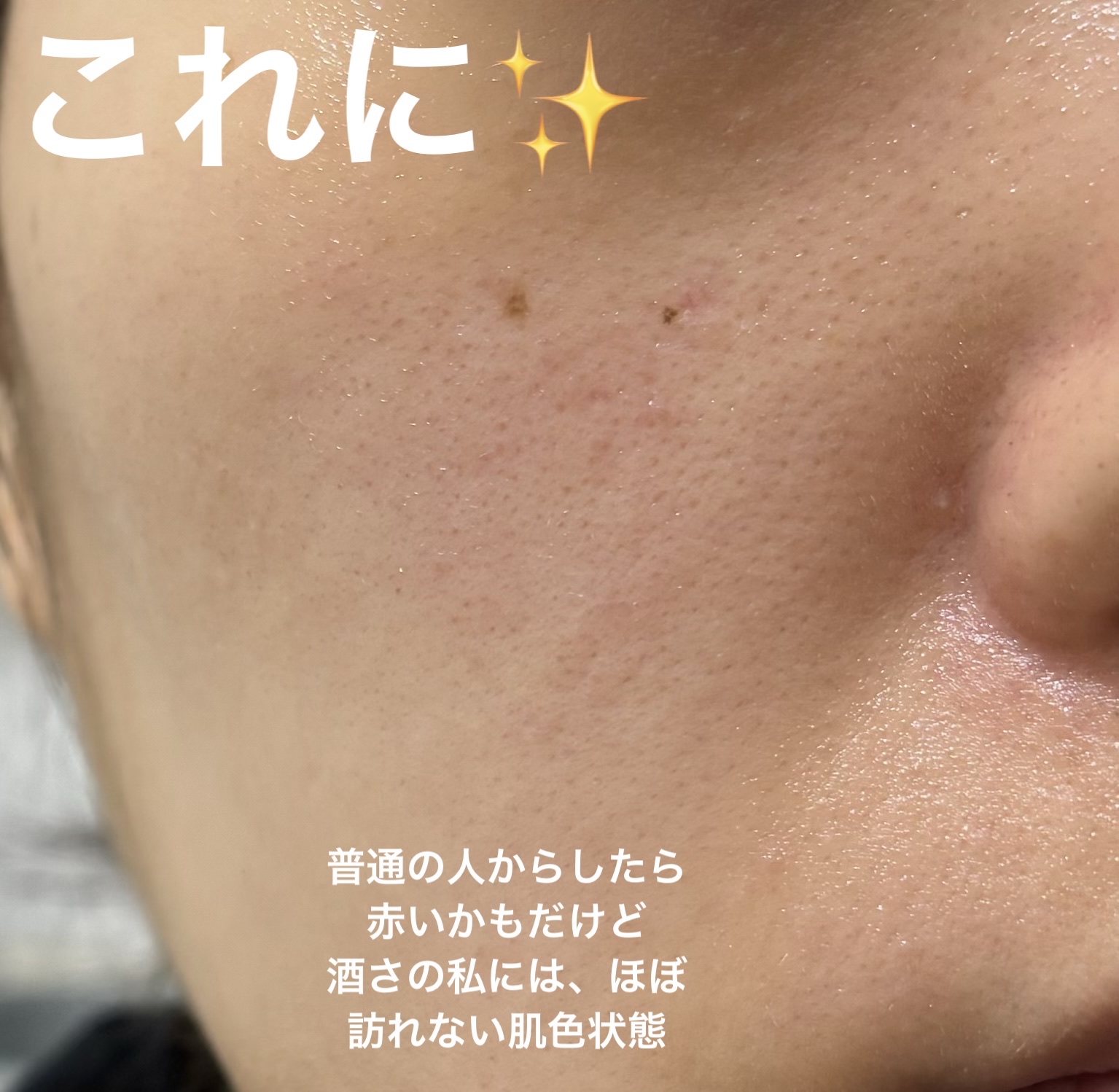 白漢 しろ彩 リペアローション/白漢しろ彩/化粧水を使ったクチコミ（3枚目）