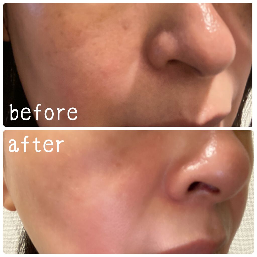 ホワイトラッシュ HQ美容液/White Rush/美容液を使ったクチコミ(4枚目)