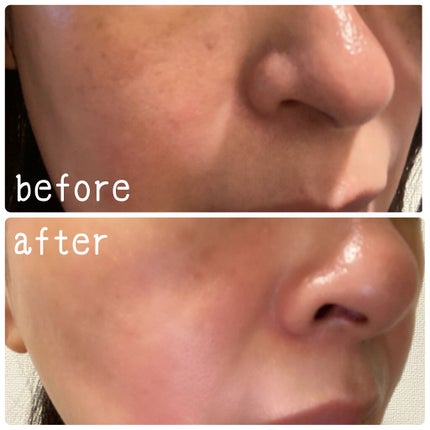 ホワイトラッシュ HQ美容液/White Rush/美容液を使ったクチコミ(4枚目)