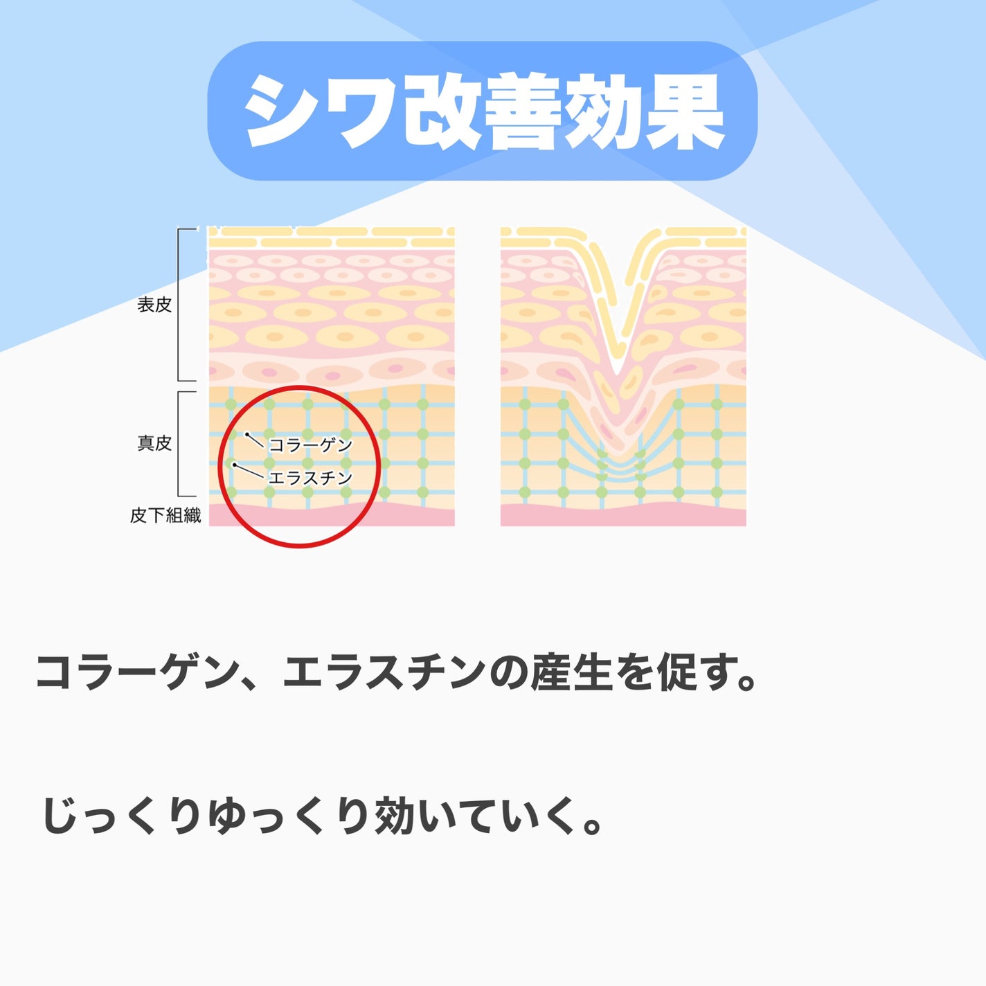 VC100エッセンスローション EX/ドクターシーラボⓇ/化粧水を使ったクチコミ(5枚目)
